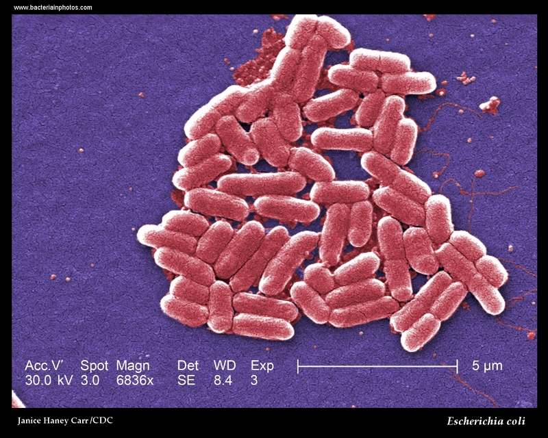 Why Traditional Methods Can’t Count the Microbes: Unveiling the Hidden Diversity of Life